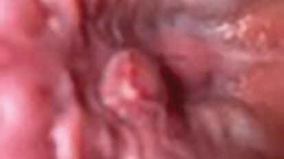 Lewis fig 2 alternate text for this image