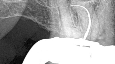 West-Fig-3d alternate text for this image