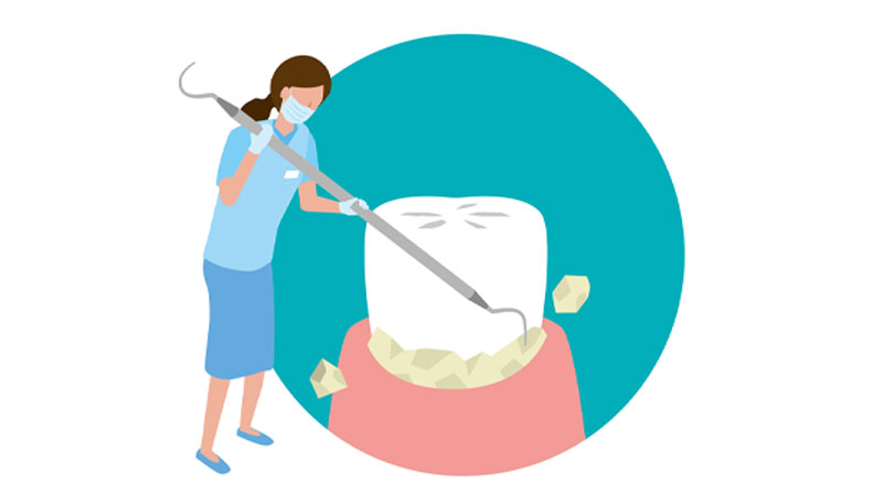 dental-hygienist alternate text for this image