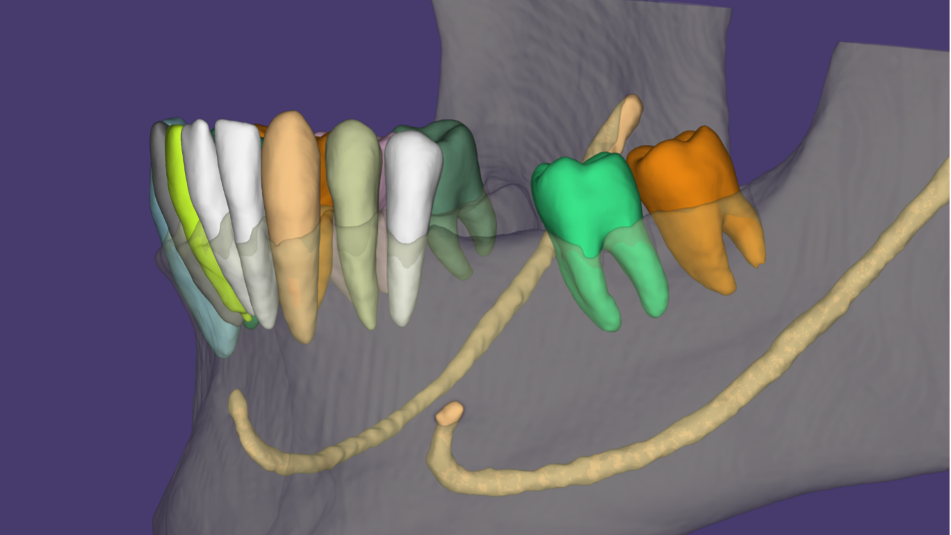 Dvoyris fig3A alternate text for this image