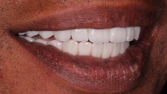 Figure 28 alternate text for this image