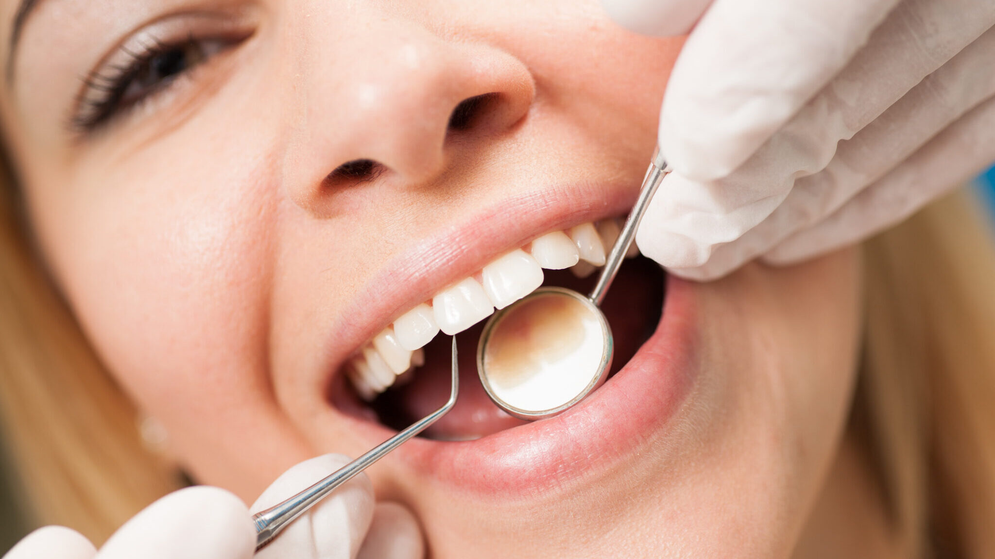 Young confident woman at  dentist’s office having routine checkup. alternate text for this image