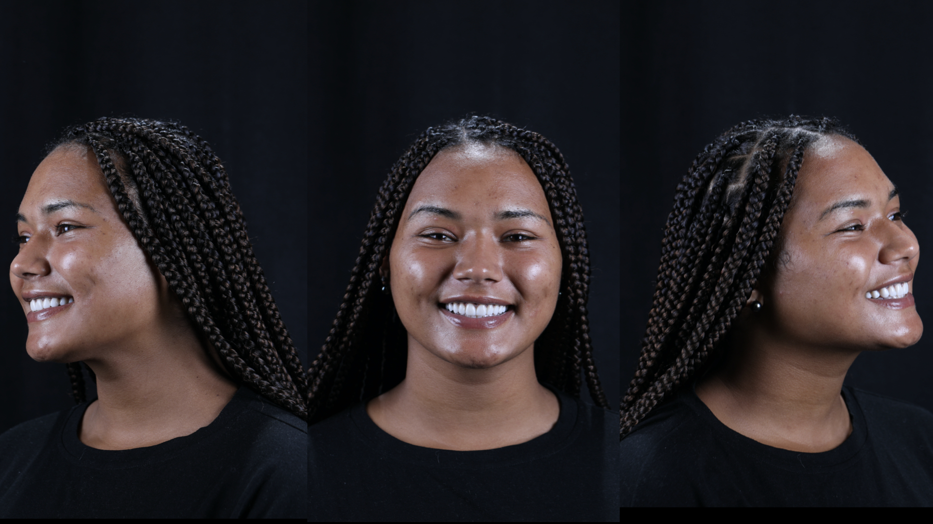 Postoperative full face views.