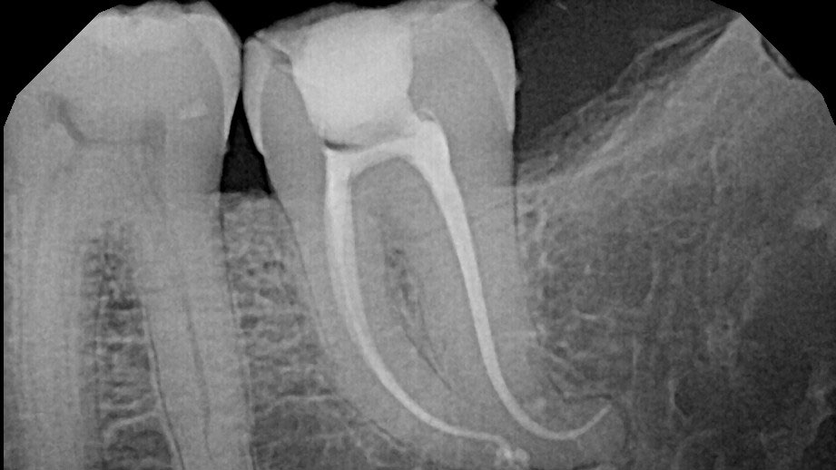 Meza_thumbnail alternate text for this image