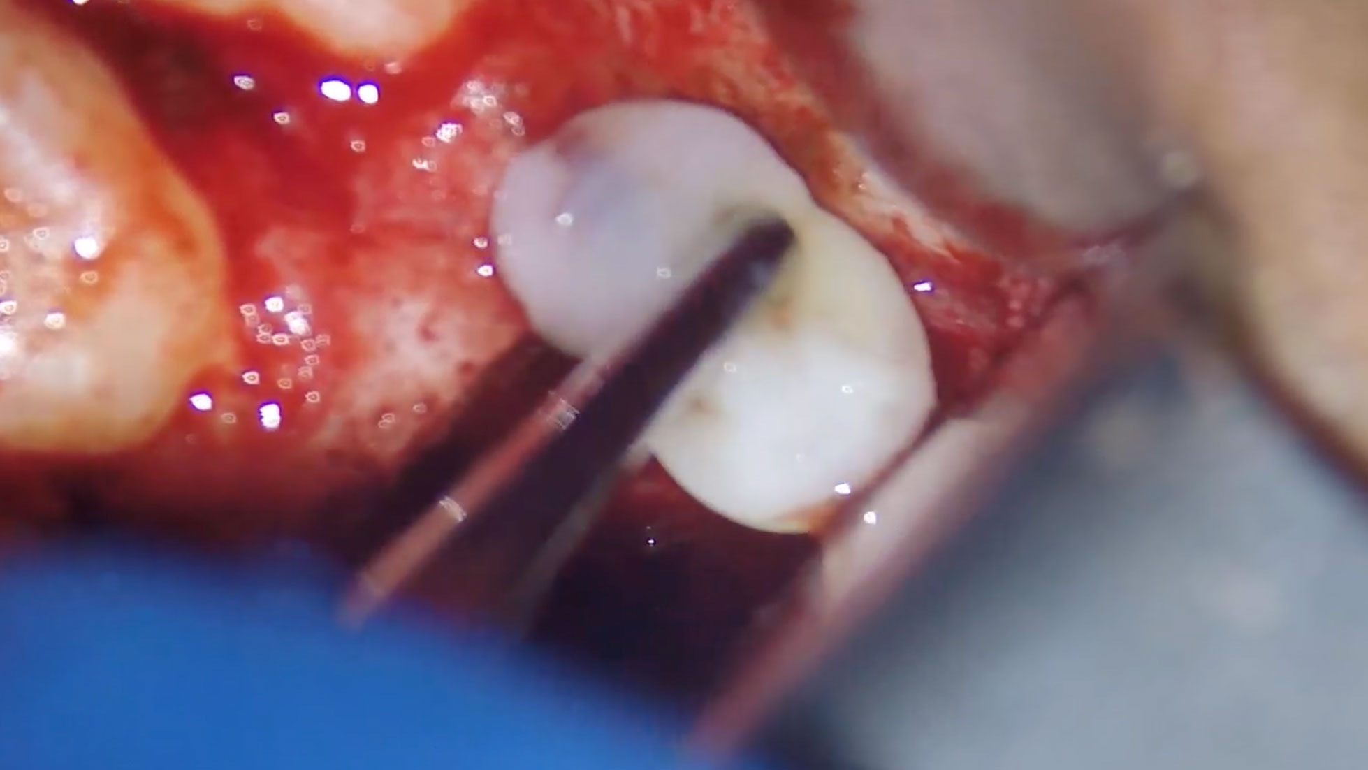 Adams_thumbnail alternate text for this image