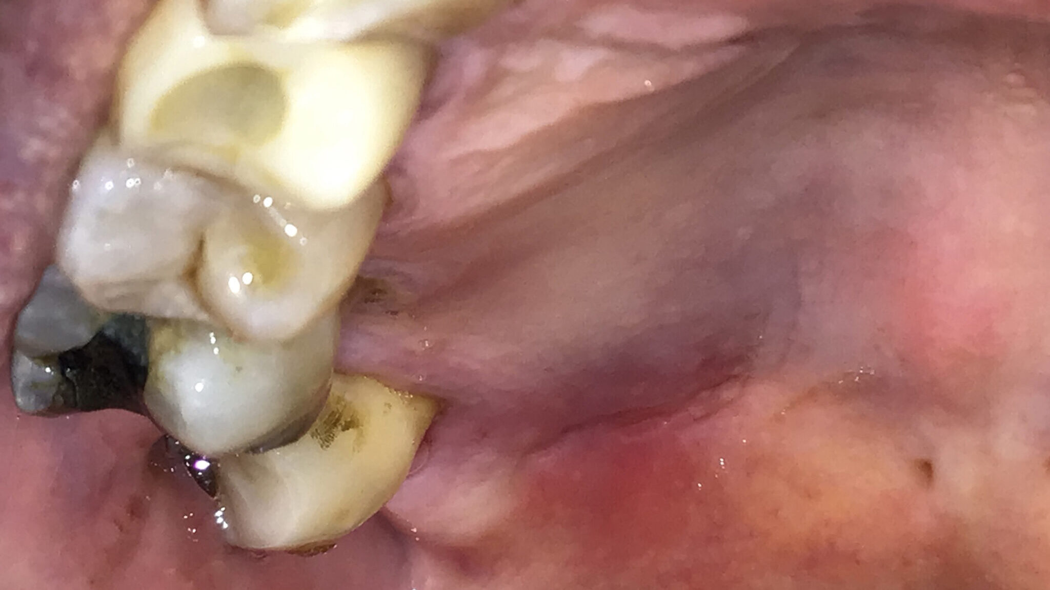 OH Article Figure 1 NEW alternate text for this image