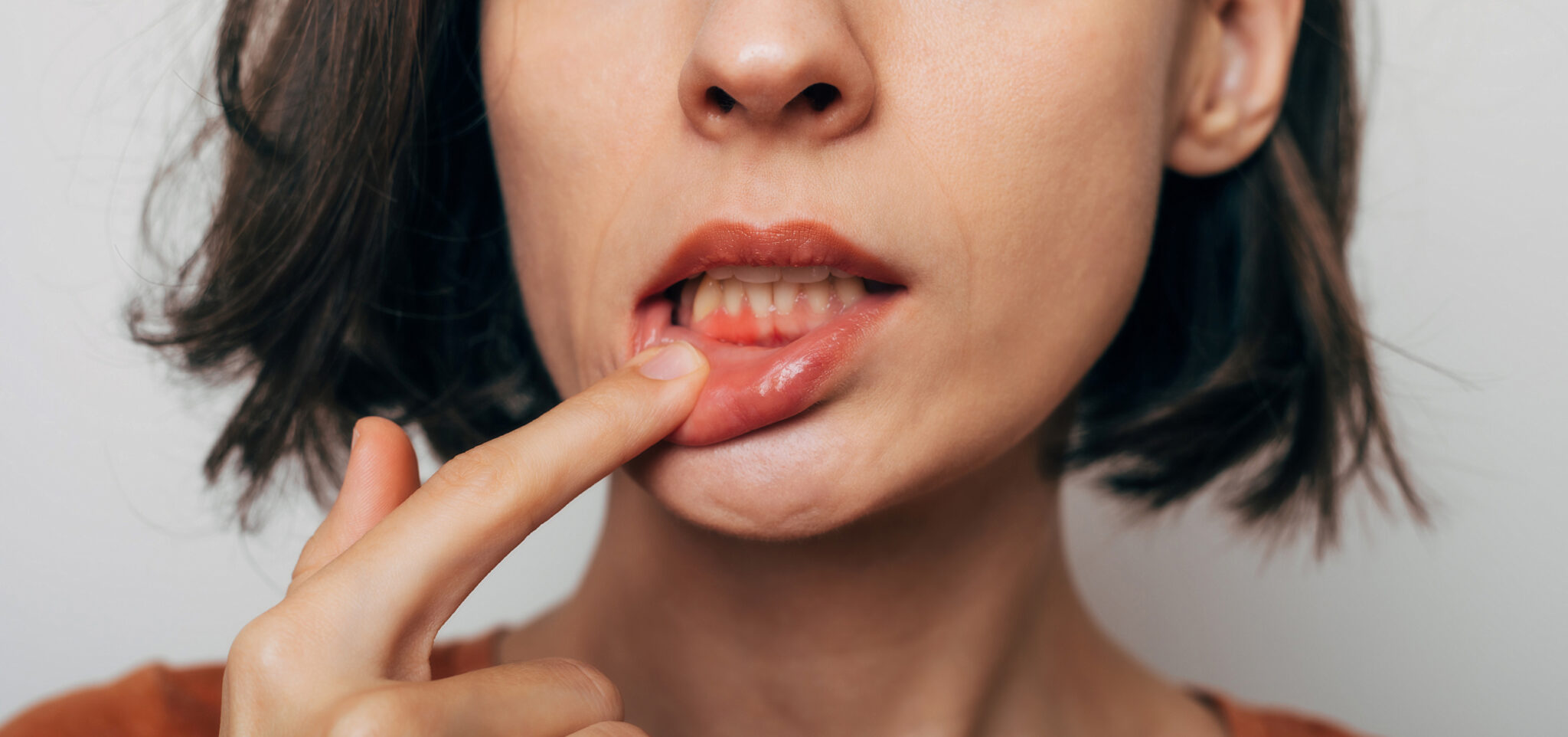 Close up shot of gum inflammation. Cropped shot of a young woman showing red bleeding gums isolated on a gray background. Dentistry, dental care alternate text for this image