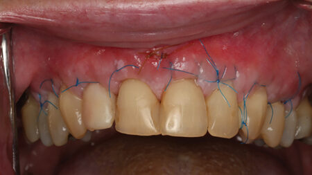 Huang Fig 3 alternate text for this image