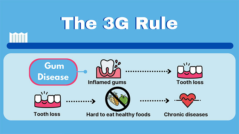 thumbnail_Supporting-Healthy-Gums-with-the-3G-Rule alternate text for this image