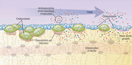 Antiresorptive therapy: 1) decreased osteoclastogenesis leads to osteoclast apoptosis and decreased bone resorption; 2) decreased osteoblastogenesis leads to decreased bone formation.19