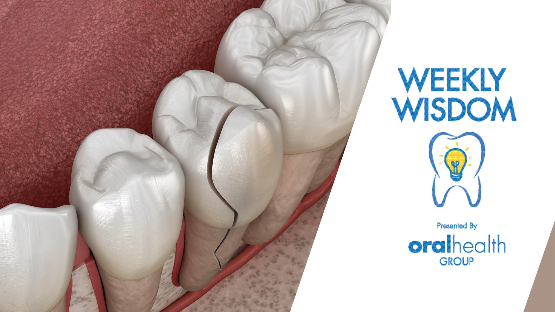 WW Thumbnail_1920x1080_270224 alternate text for this image