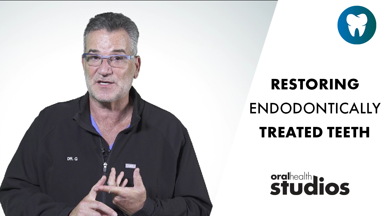 Restoring-Endodontically-Treated-Teeth alternate text for this image