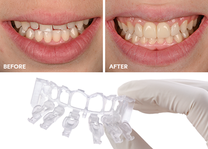 Picture2 alternate text for this image