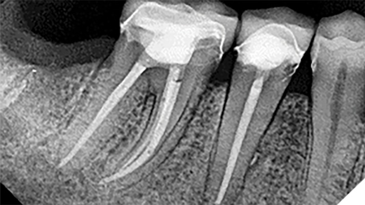 Gilbert-featured-image alternate text for this image