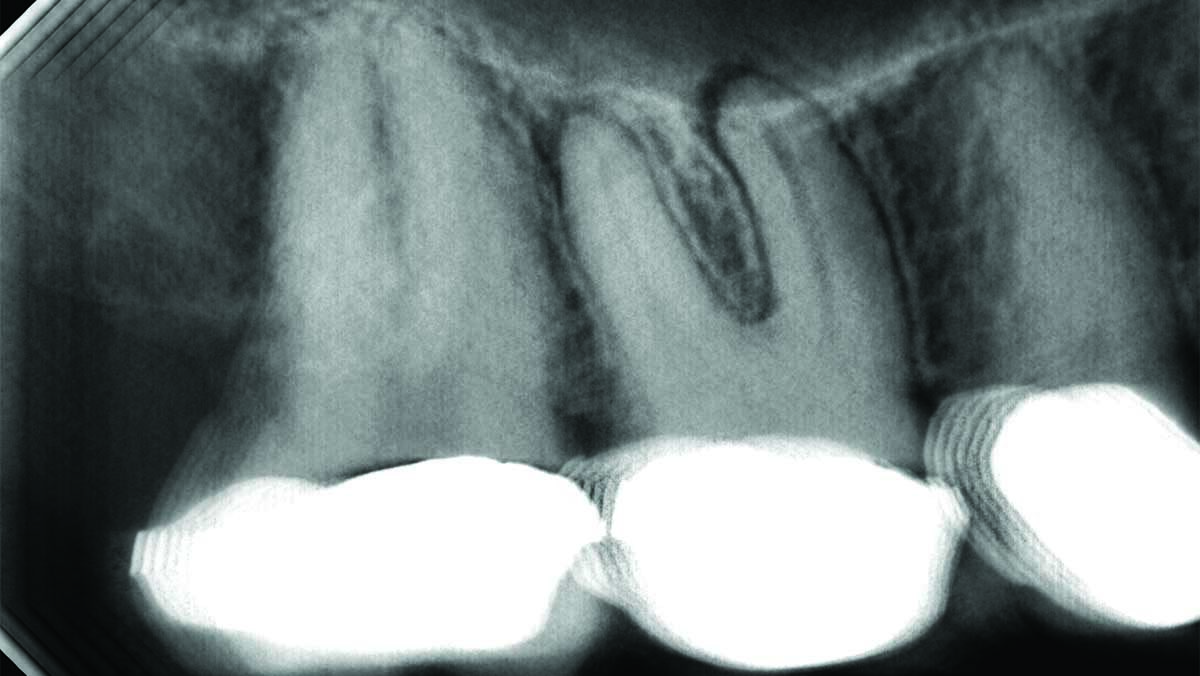 Landwehr-fig_3B alternate text for this image