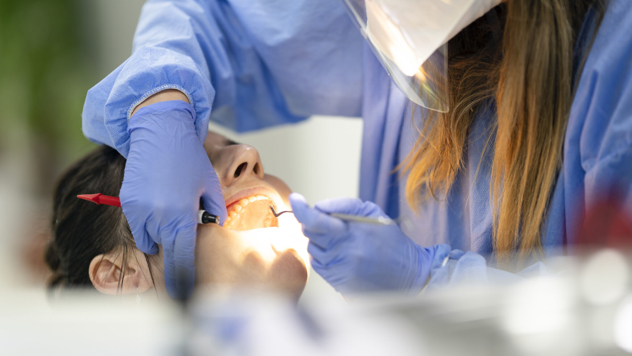 Dental exam at dentist office alternate text for this image