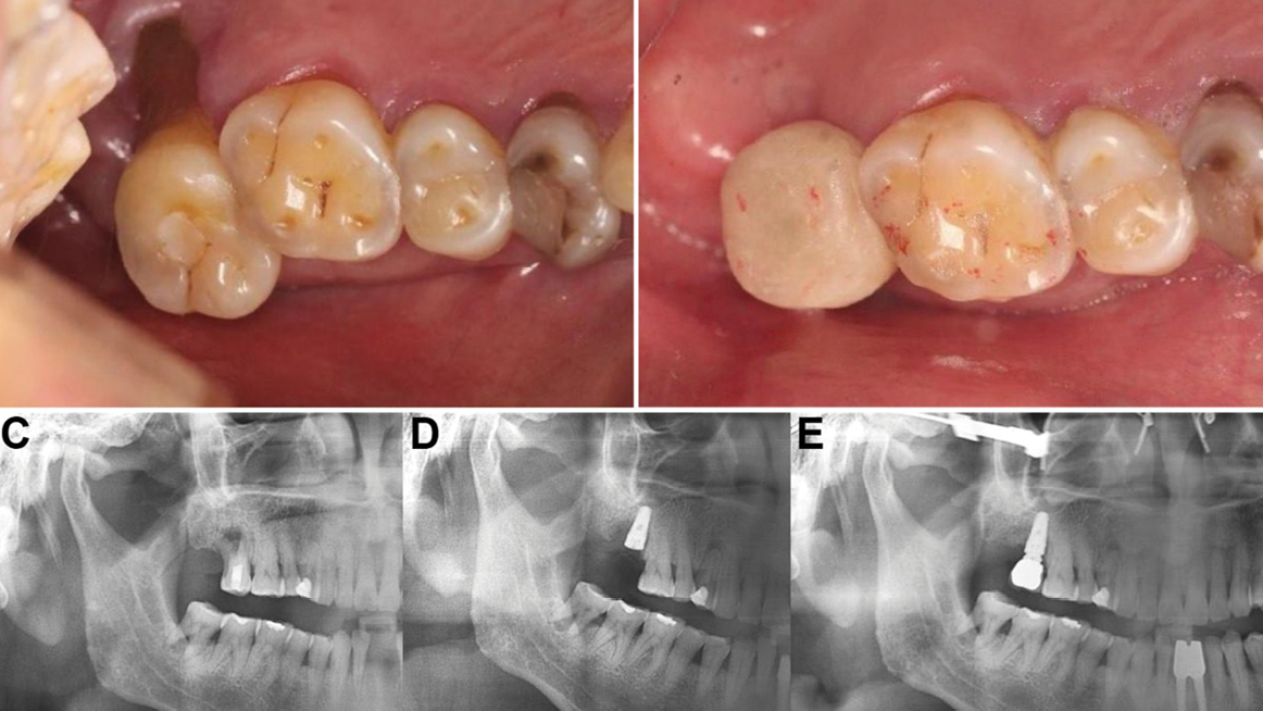 Chen2_Fig_3A-3H alternate text for this image