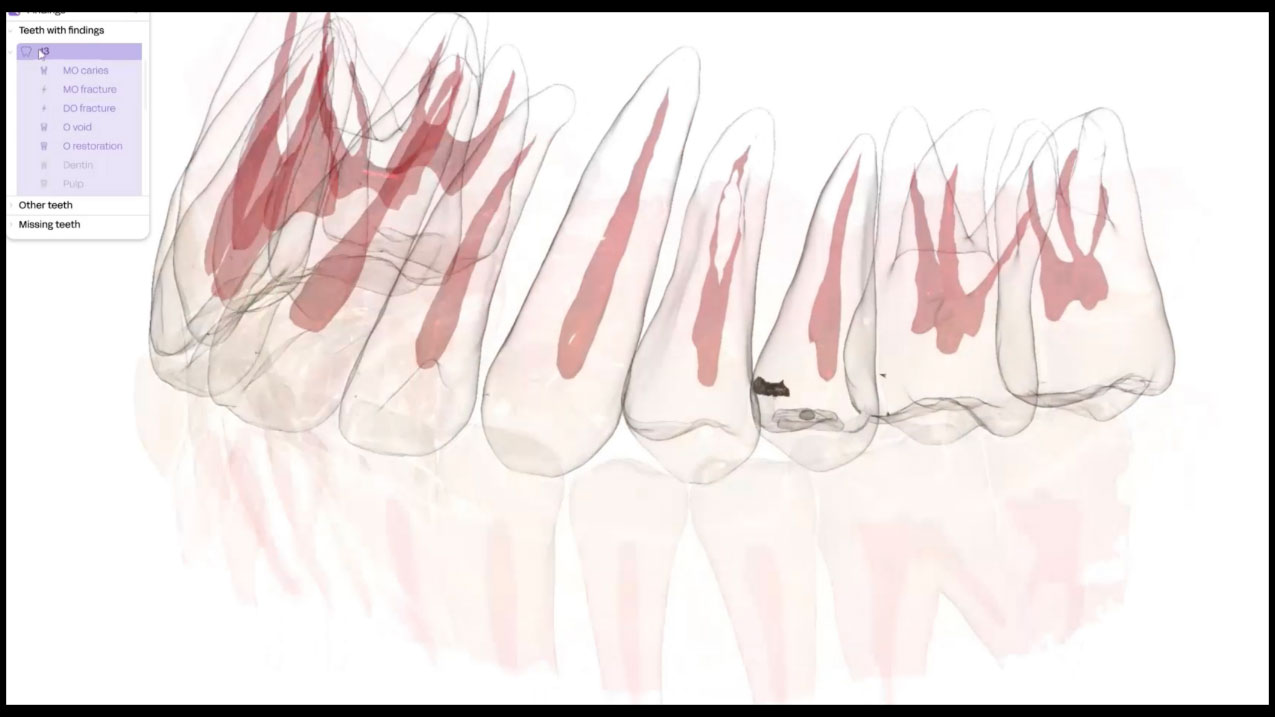 perceptive alternate text for this image