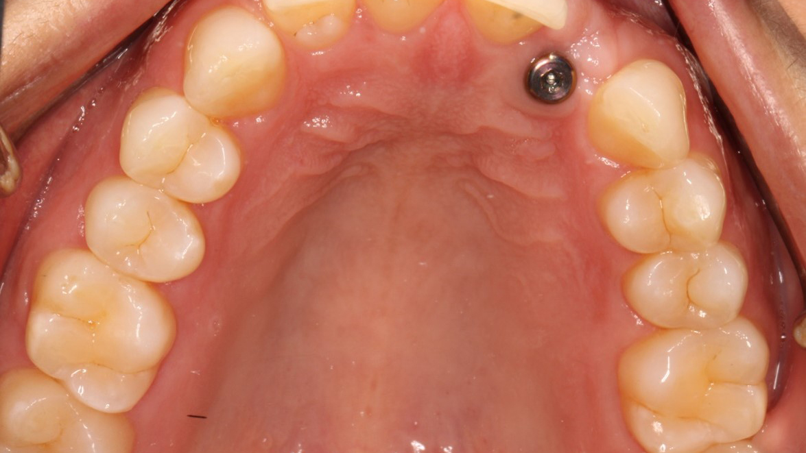 Al-fig 1- MAIN alternate text for this image