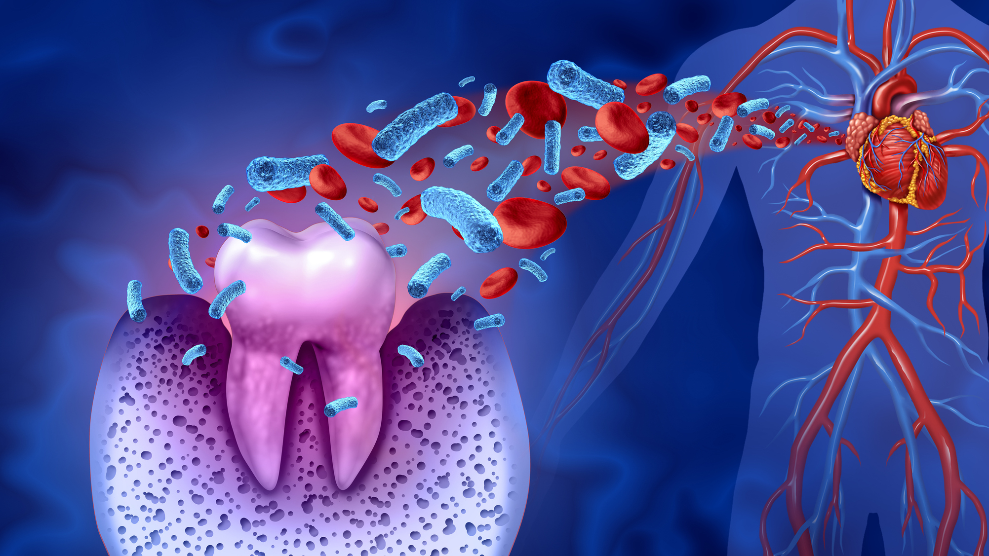 Israeli researchers discover how P. gingivalis evades the immune system, paving the way for new treatments to combat periodontal disease and related systemic conditions.