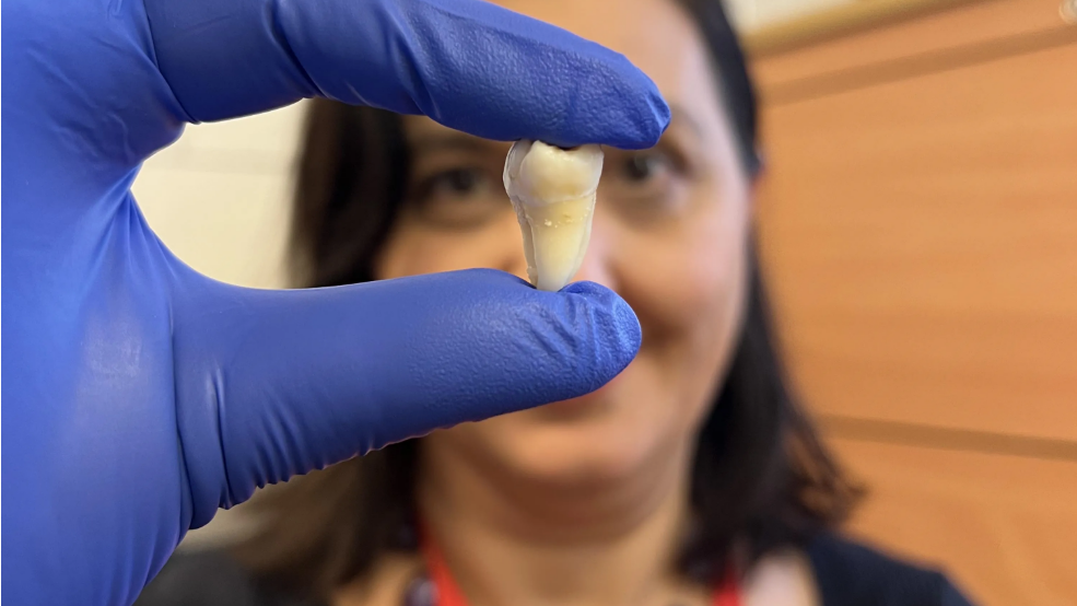 Dr Ana Angelova Volponi holding a tooth