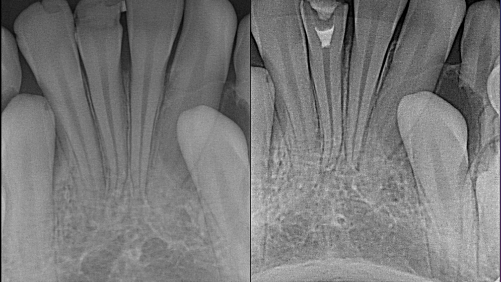 Damas-Case-1a-thumbnail alternate text for this image