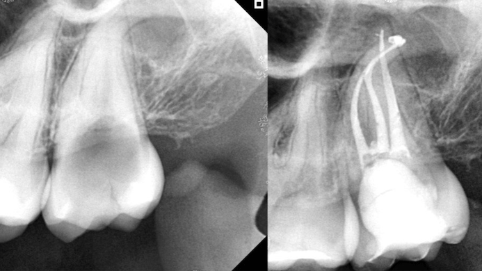 Serota-Fig-10AB-thumbnail alternate text for this image