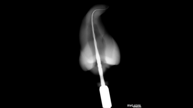 yared_thumbnail alternate text for this image