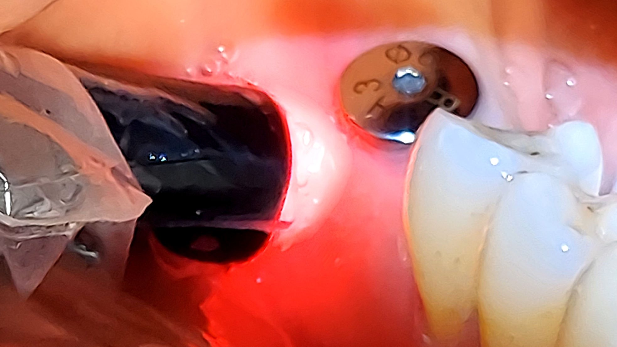 Fig. 1 alternate text for this image