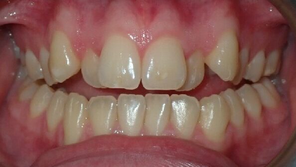 Fig 3A __ NEW alternate text for this image