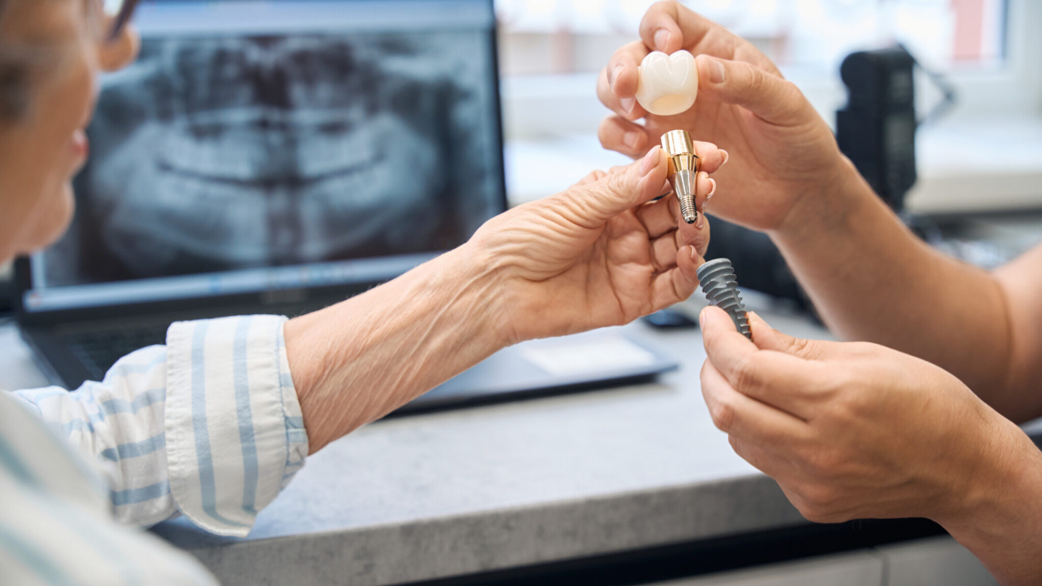 Prosthetist consults an elderly lady in a dental clinic, he shows her a model of a dental implant. (iStock)