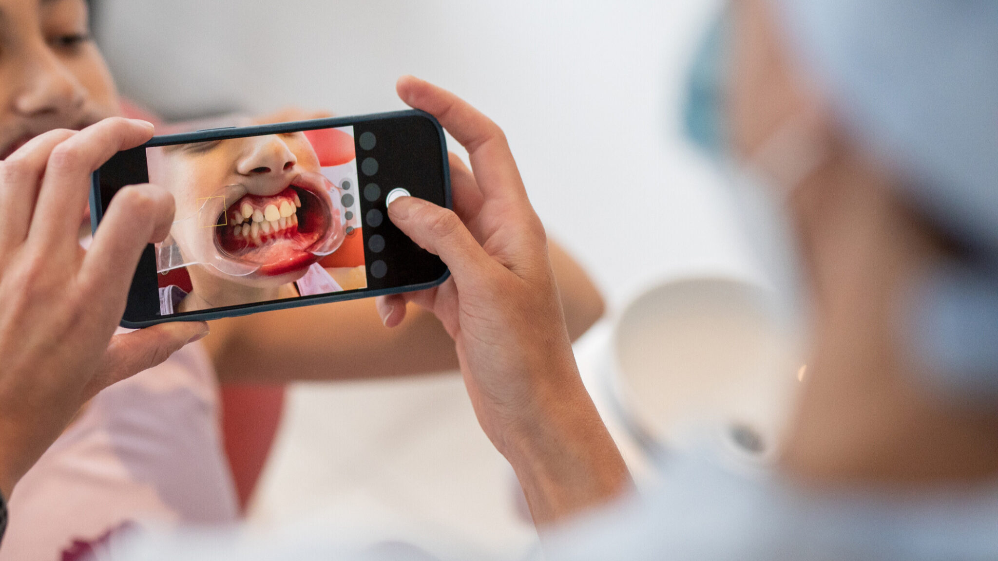 teledentistry alternate text for this image