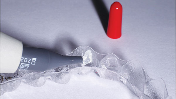 Fig_18-gange alternate text for this image