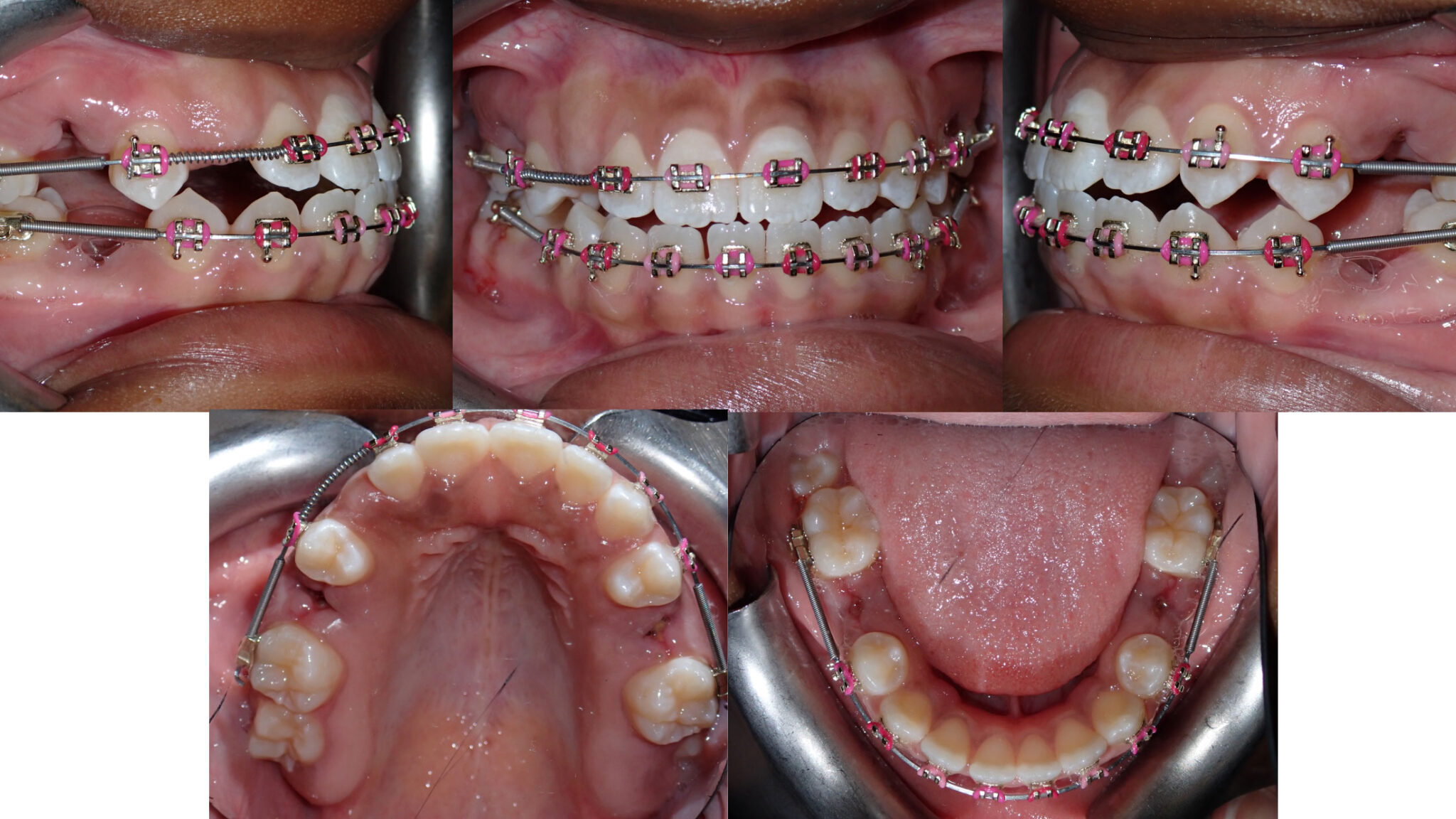 Figure-4-vuong alternate text for this image