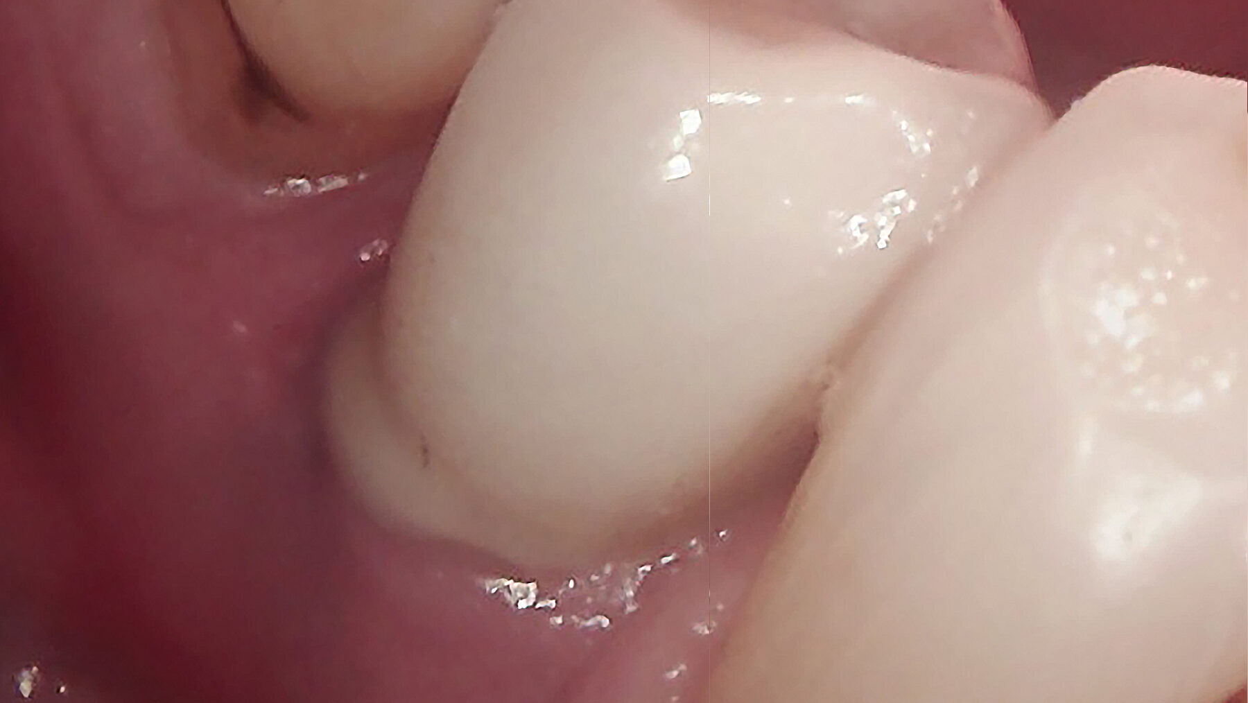 Figure 5a alternate text for this image