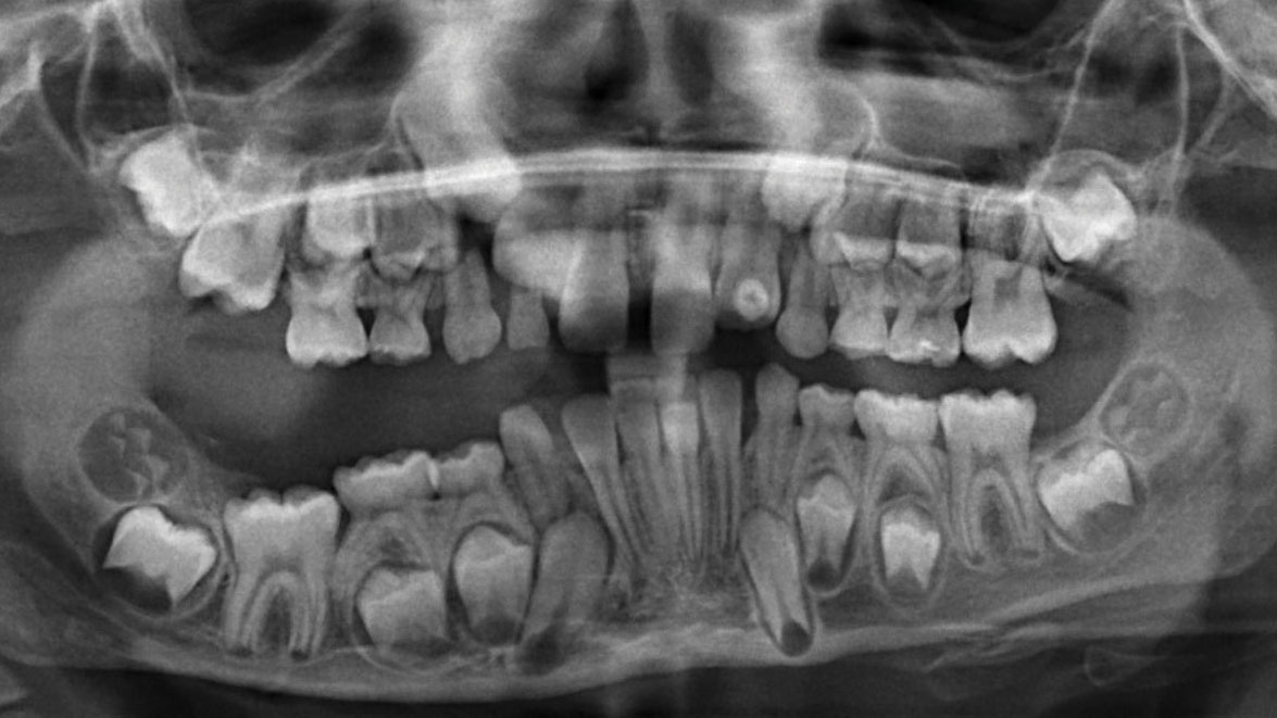 lymphatic-disease-dentistry-boyce alternate text for this image