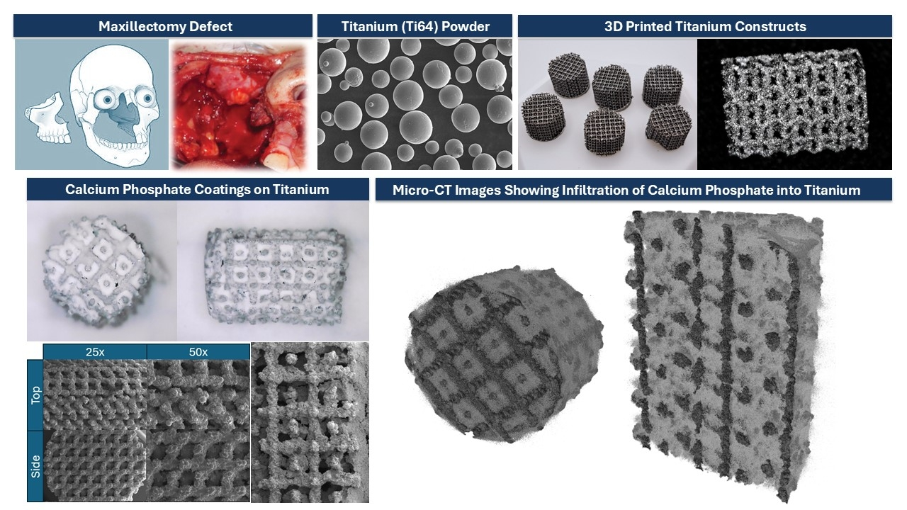 3D-printed-titanium-constructs-sheikh alternate text for this image