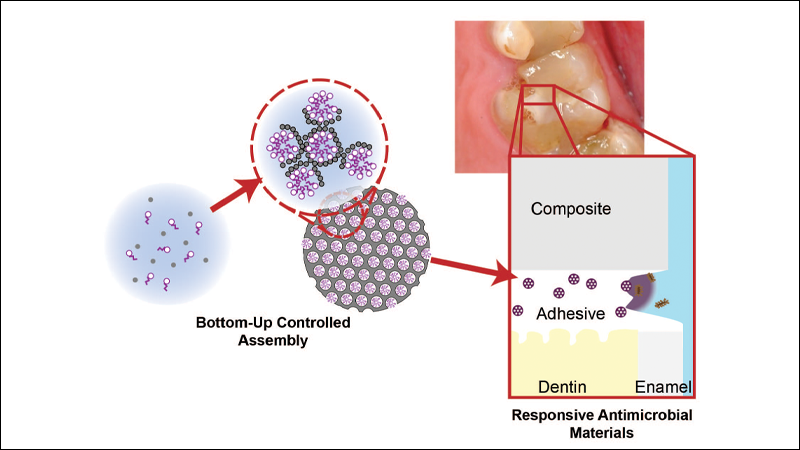 antimicrobial-dental-materials-stewart alternate text for this image