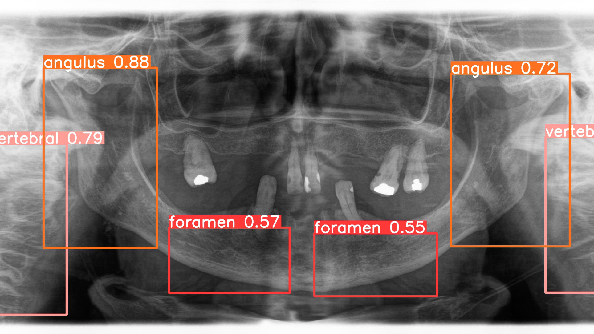 gaudin-thumbnail alternate text for this image