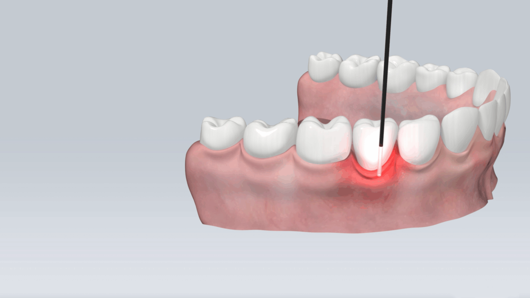 glass-dentistry-frank alternate text for this image